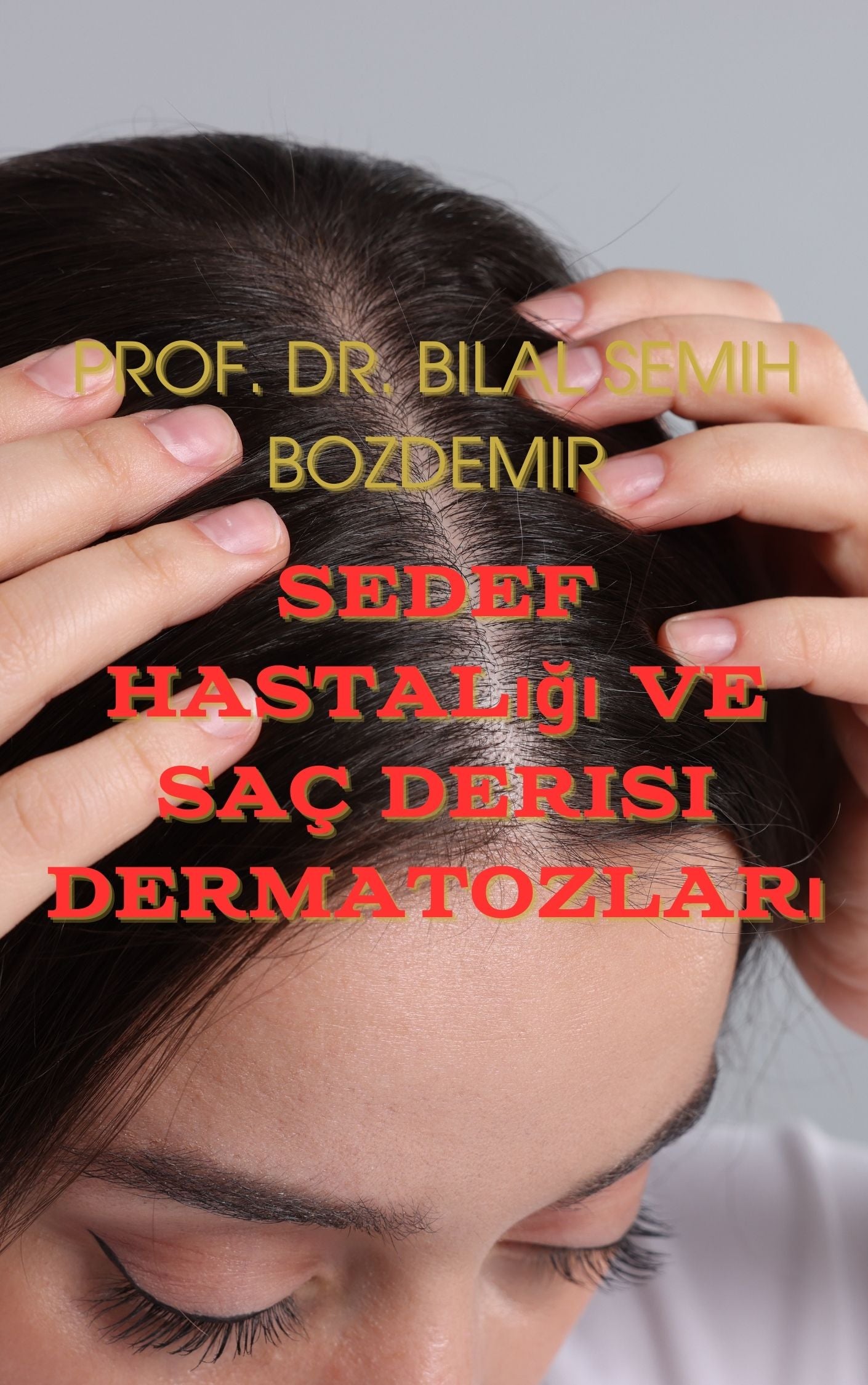 Sedef Hastalığı ve Saç Derisi Dermatozları (İndirilebilir PDF)