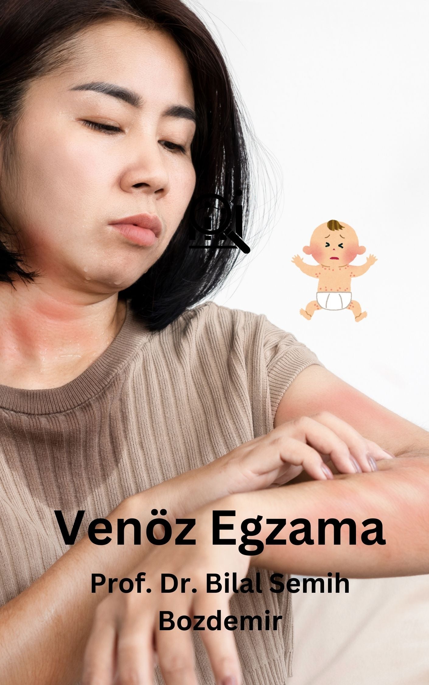 Venöz Egzama (Basılı, Adrese Teslim)