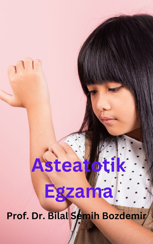 Asteatotik Egzama (Basılı, Adrese Teslim)