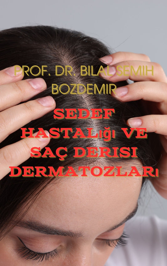 Sedef Hastalığı ve Saç Derisi Dermatozları (Basılı, Adrese Teslim)